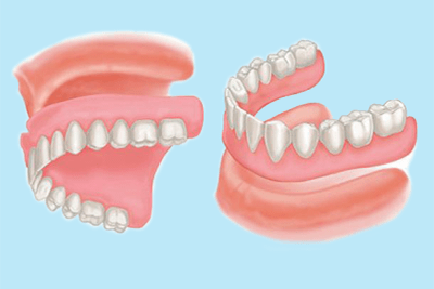 teeth-example.png